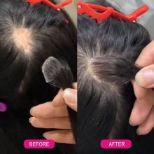 Hair Pieces HD lace 100% human hair for the hair loss